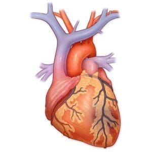 Myocardial Infarction An Unavoidable Risk
